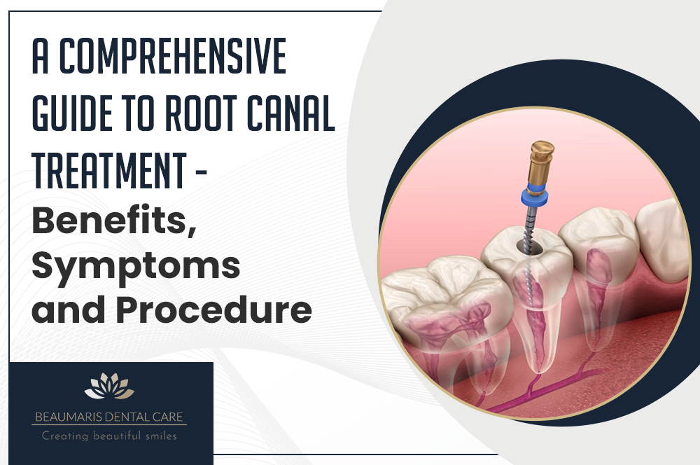 A Comprehensive Guide to Root Canal Treatment - Benefits, Symptoms and Procedure